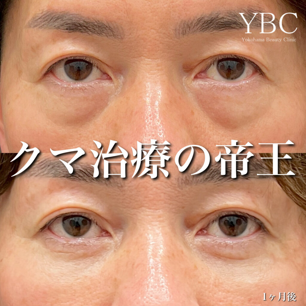 クマ治療50代男性