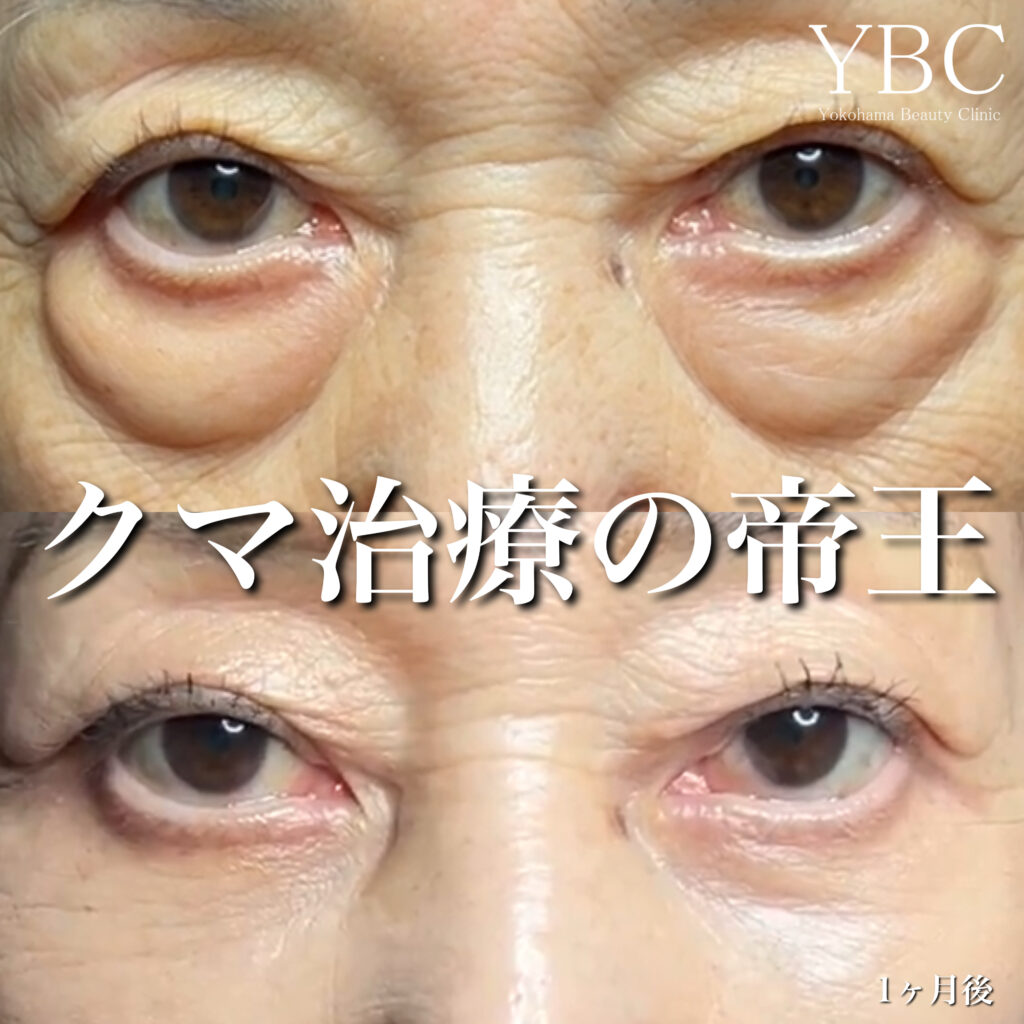 70代クマ治療